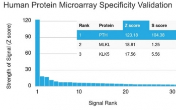 Recombinant PTH Antibody (N-Terminal) / Rabbit Monoclonal