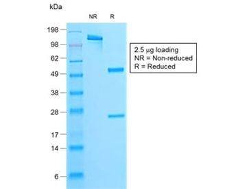 Recombinant Parathyroid Hormone Antibody / N-Terminal