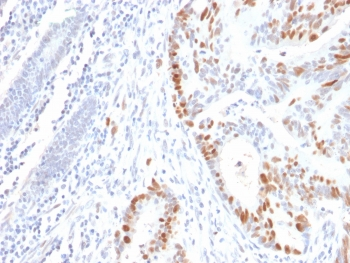 Recombinant TP53 Antibody (N-Terminal Region)