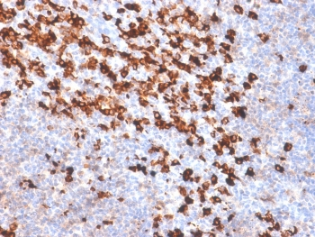 Recombinant Biotin Antibody / Rabbit Monoclonal