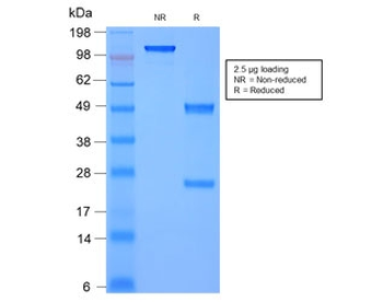 Recombinant Moesin Antibody