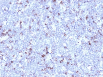 Recombinant CD43 Antibody