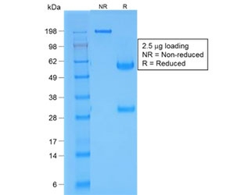 Recombinant TTF-1 Antibody / NKX2.1