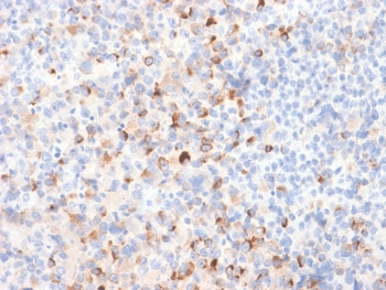 Recombinant Tyrosinase Antibody