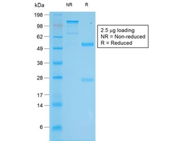 Recombinant Tyrosinase Antibody