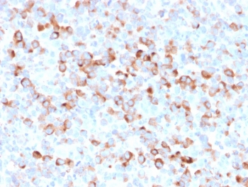 Recombinant TYR Antibody / Tyrosinase