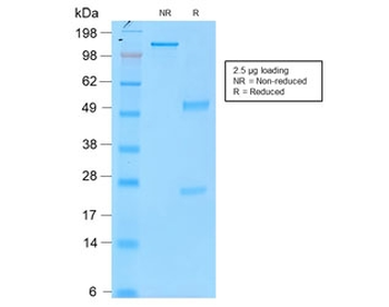 Recombinant TYR Antibody / Tyrosinase