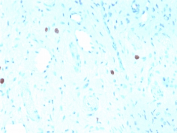 Recombinant HPV16 L1 Antibody