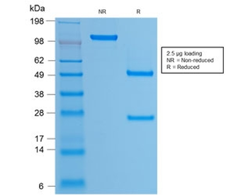 Recombinant HPV16 L1 Antibody