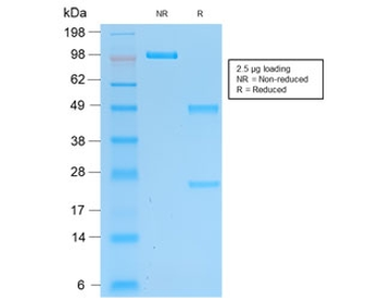 Recombinant PGP9.5 Antibody