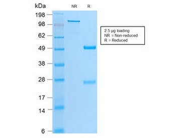 Recombinant MyoD Antibody / Rabbit Monoclonal
