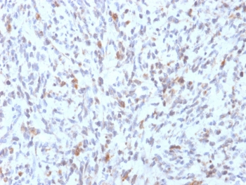 Recombinant MyoD1 Antibody