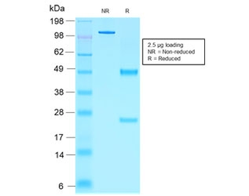 Recombinant NKX2.2 Antibody