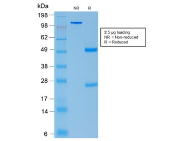 Recombinant ACTH Antibody / CLIP