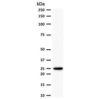 Recombinant Bcl-2 Antibody / Rabbit Monoclonal