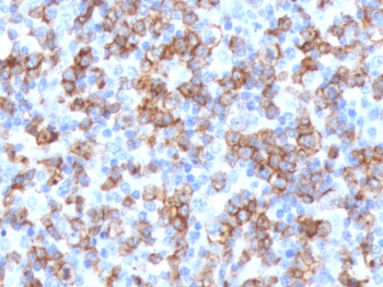 Recombinant CD8 Antibody (alpha chain) / Rabbit Monoclonal
