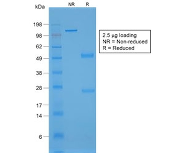 Recombinant von Willebrand Factor Antibody