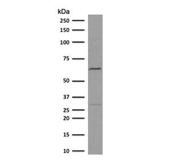 Recombinant Estrogen Receptor alpha Antibody