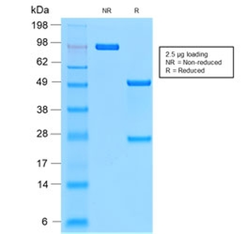 Recombinant Mucin-1 Antibody / Rabbit Monoclonal