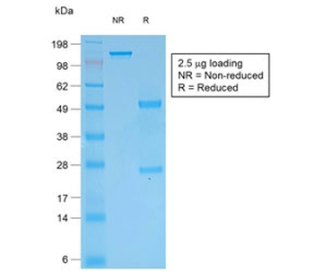 Recombinant Multi Cytokeratin Antibody