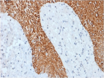 Recombinant Multi Cytokeratin Antibody / Rabbit Monoclonal