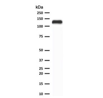 Recombinant E-Cadherin Antibody / Rabbit Monoclonal