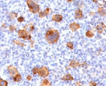 Recombinant CD30 Antibody