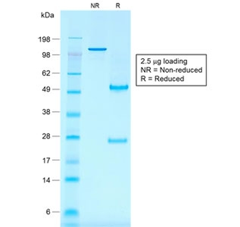 Recombinant CD30 Antibody