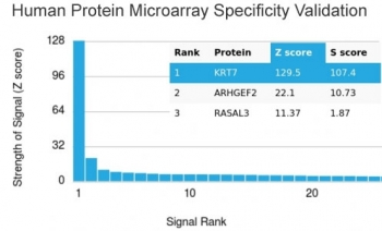 Recombinant Cytokeratin 7 Antibody