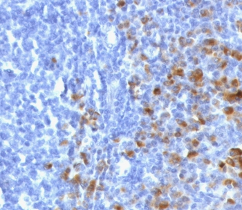 Recombinant IgG Antibody / Rabbit Monoclonal