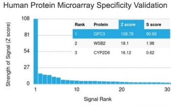 Recombinant GPC3 Antibody / Glypican-3