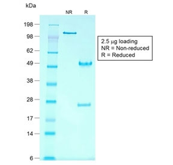 Recombinant GPC3 Antibody / Glypican-3