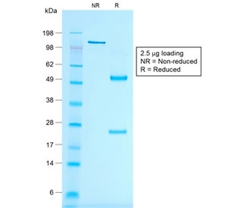 Recombinant Melan-A Antibody