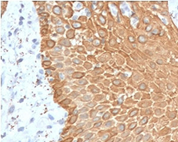 Recombinant Multi Cytokeratin Antibody / Rabbit Monoclonal