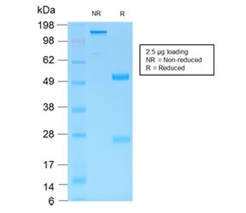 Recombinant Gastric Mucin Antibody / MUC6 / Rabbit Monoclonal
