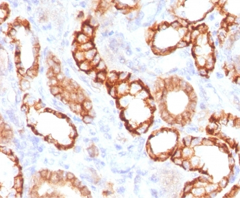 Recombinant Cadherin 16 Antibody / Rabbit Monoclonal