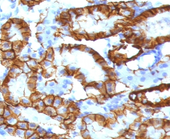 Recombinant Cadherin 16 Antibody / Rabbit Monoclonal