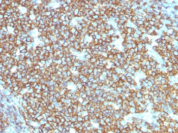 Recombinant CD20 Antibody