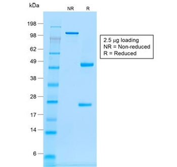 Recombinant CD20 Antibody