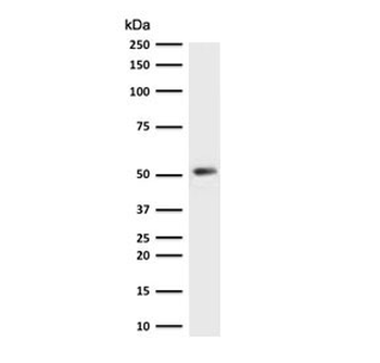 Recombinant Cytokeratin 7 Antibody / Rabbit Monoclonal