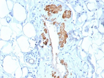 Recombinant SMMHC Antibody