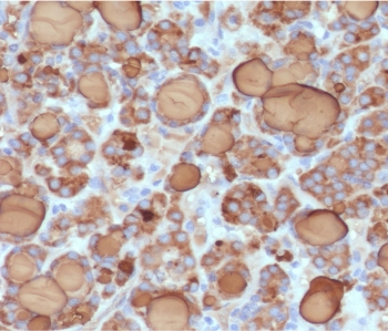 Recombinant Thyroglobulin Antibody / Rabbit Monoclonal