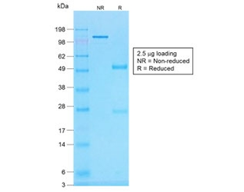 Recombinant Histone H1 Antibody
