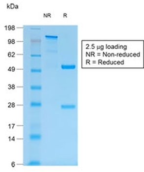 Recombinant Mucin-1 Antibody / Rabbit Monoclonal