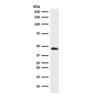 Recombinant Cytokeratin 19 Antibody / Rabbit Monoclonal
