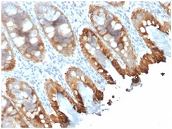 Recombinant Cytokeratin 8/18 Antibody