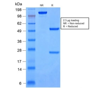 Recombinant Cytokeratin 8/18 Antibody
