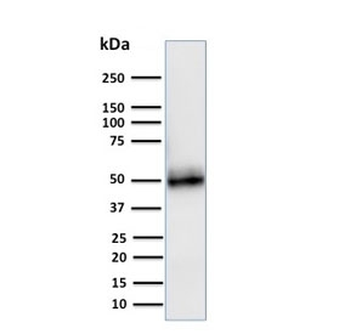 CD14 Antibody (Macrophage Marker)