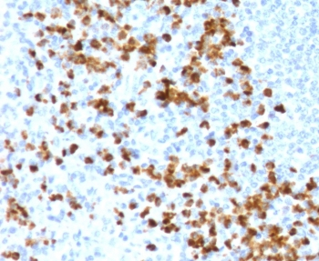 Recombinant MMP9 Antibody / Rabbit Monoclonal