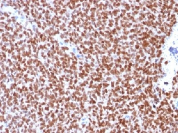 Recombinant NKX2.2 Antibody